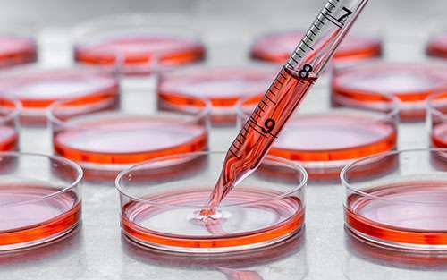 Pancreatic cancer blood tests are being developed to help early detection.