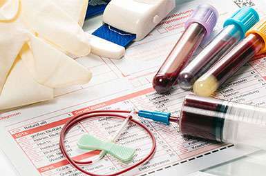 Panels of biomarkers found in blood samples may lead to earlier detection of pancreatic cancer