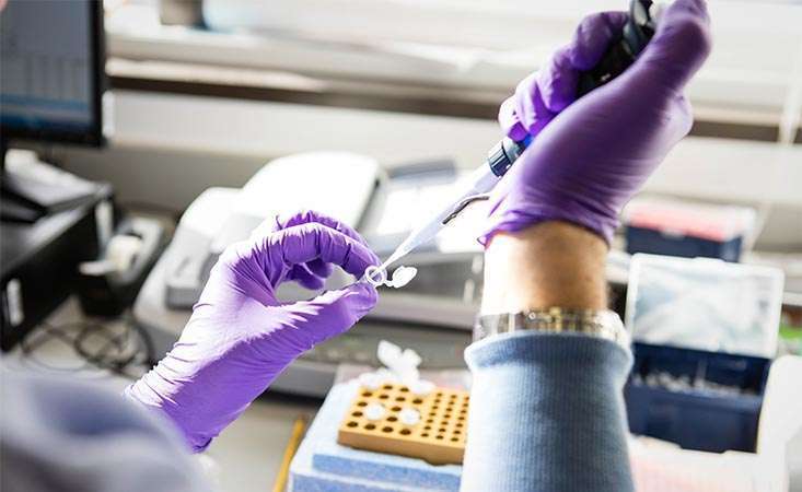 Biomarkers are substances in the body that can help diagnose pancreatic cancer and monitor it