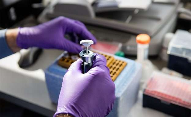 Feature image Researchers look for molecular clues in samples from more than 3,500 pancreatic cancer patients