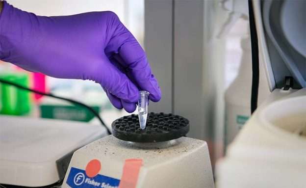 Feature image Pancreatic cancer researcher studies immune T-cells in the laboratory to improve immunotherapy