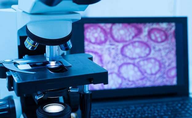 Feature image Microscope in pancreatic cancer research lab analyzes tissue sample